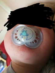 What's this rash?