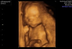 First Scan Picture