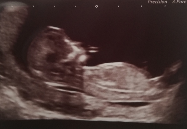 Gender guesses 💙❤️