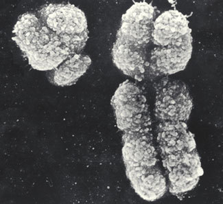 Y chromosome