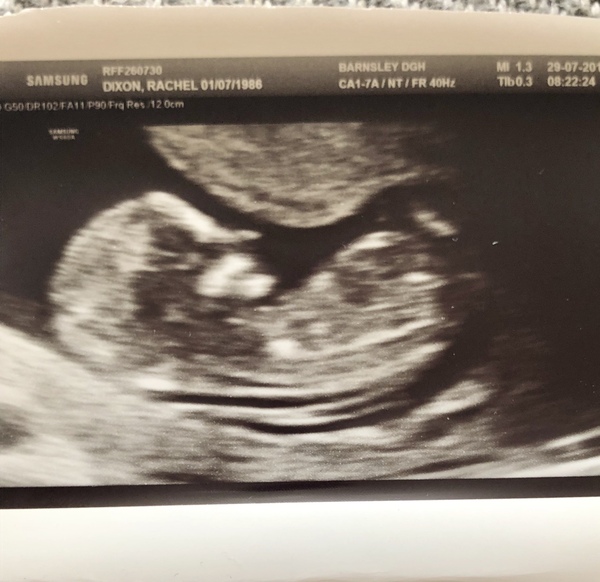 Gender guess