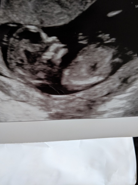 Boy or girl? You had it right last time!