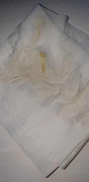 TMI but first pregnancy is this mucus plug?