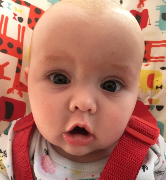 Does my baby have a cold sore?!