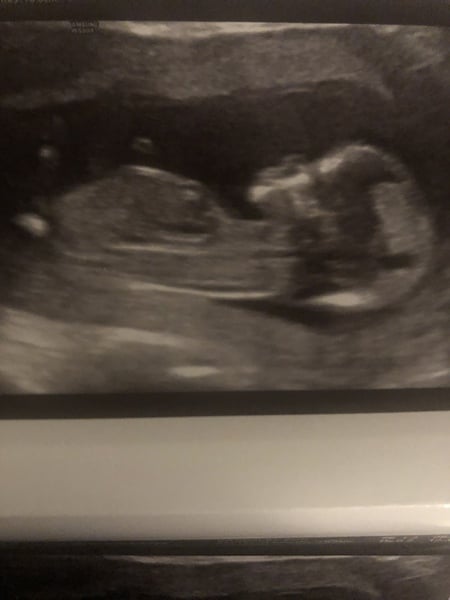 Another gender guess....