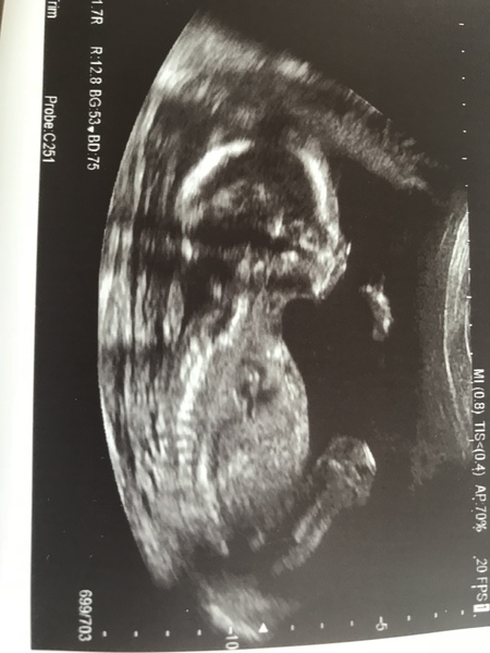 Christmas babies part 2