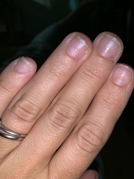 Can someone explain nails to me, please?