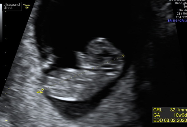 Due in Feb 2020
