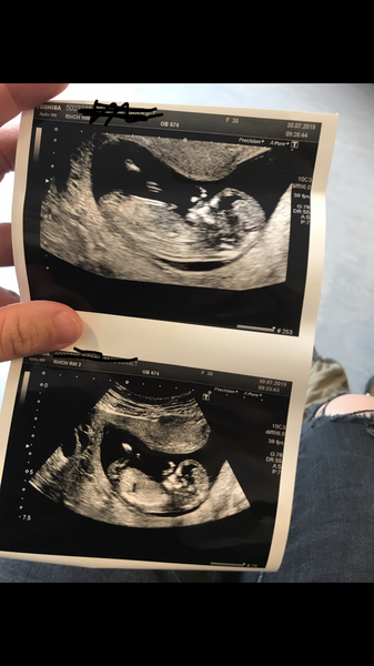 BFP - Anyone else feb 2020? Continued ...