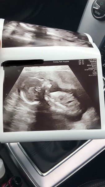 I had my 20 week scan :)