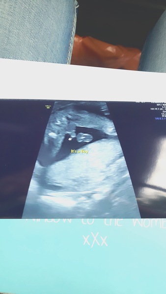 Potty shot, girl or boy?!