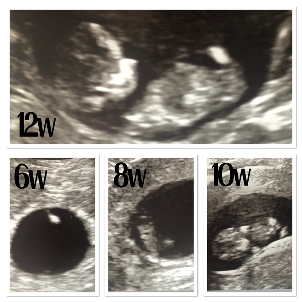 Girl or boy guesses please 💕