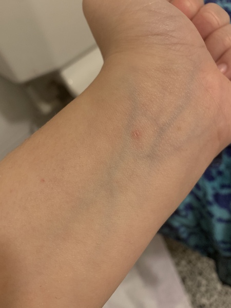 to wonder what this rash is?