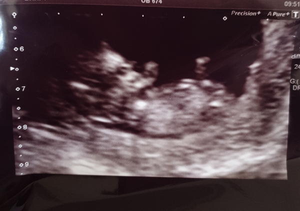 Weird scan picture, anyone want to hazard a guess?!