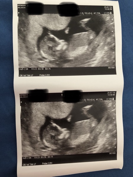 Boy or girl!?