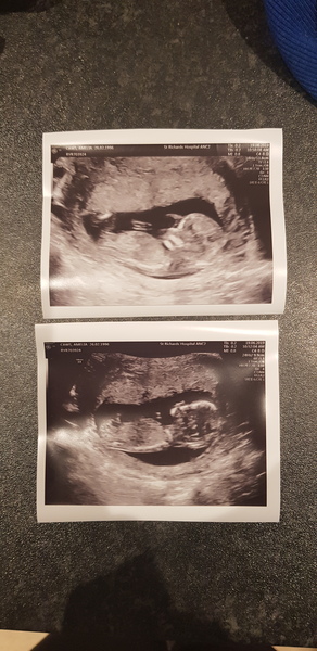 Gender guesses please!