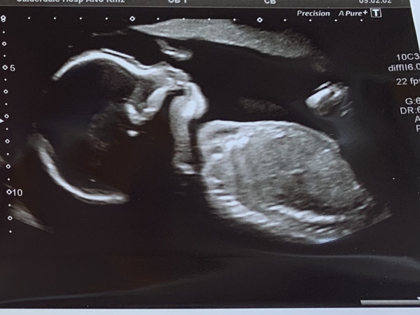 Due December 2019- continued