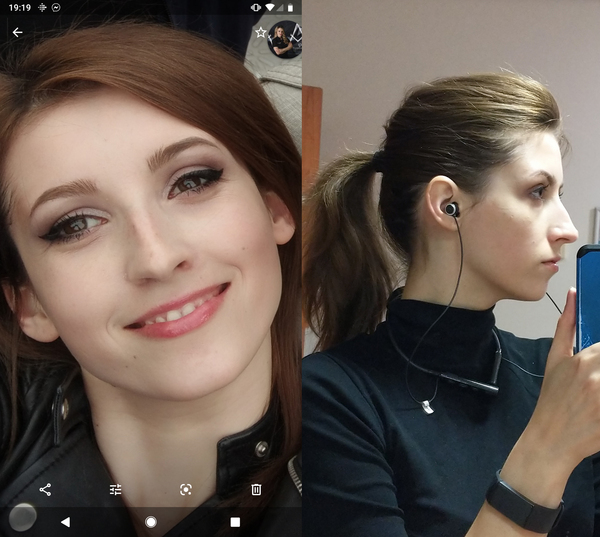 To consider a nose job/rhinoplasty? Photos