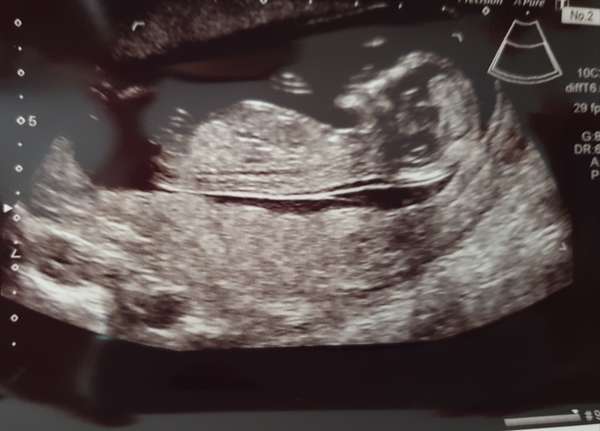 Jan 2020 - Thread 5!!