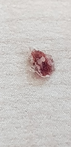 To Ask Sporners What The Hell Is This?