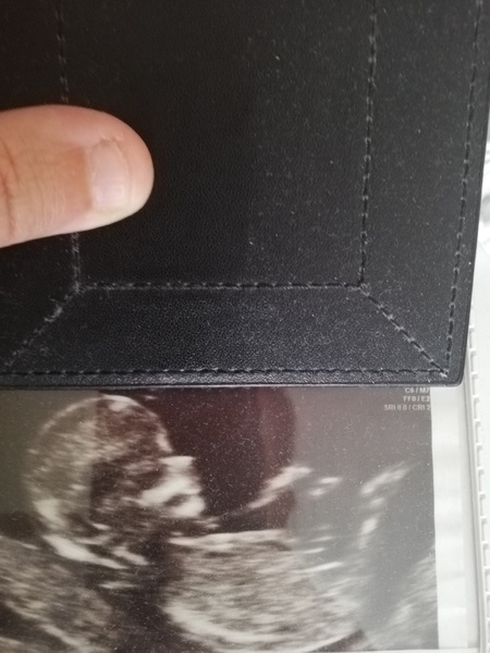 Nub experts.. Baby already born but want to see how accurate the theory is