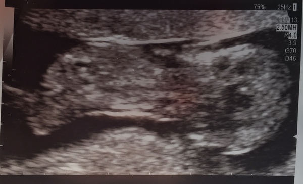 Jan 2020 - Thread 5!!