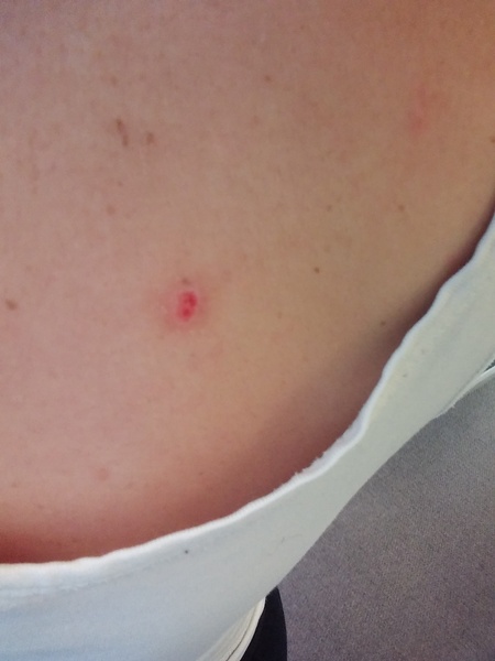 I pulled something weird out of my back (pic included)