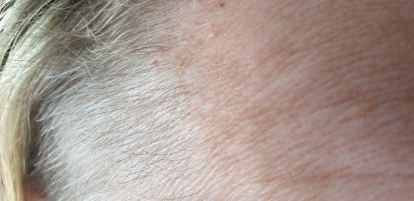 Why is my skin so rank?