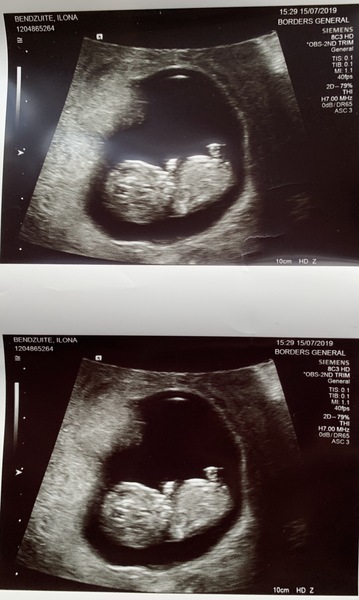 New babies sex
