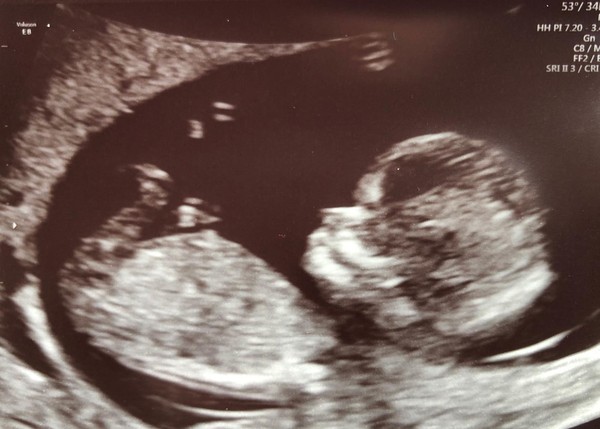 January babies, pregnant after miscarriage :)