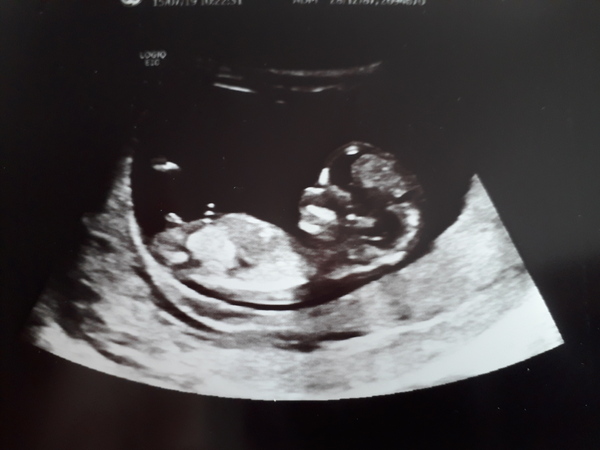 Jan 2020 - Thread 5!!