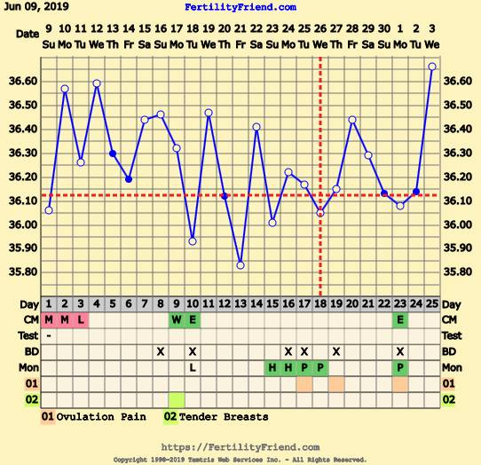 First Pregnancy Missed Miscarriage (Part III)