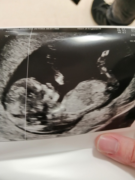 TTC First Baby Thread 20