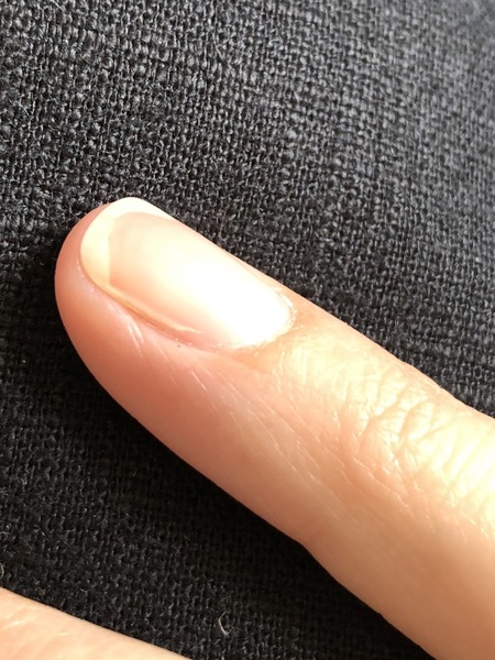 Nail lifting from bed after mani!!