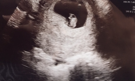 March Babies