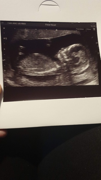 Girl or boy