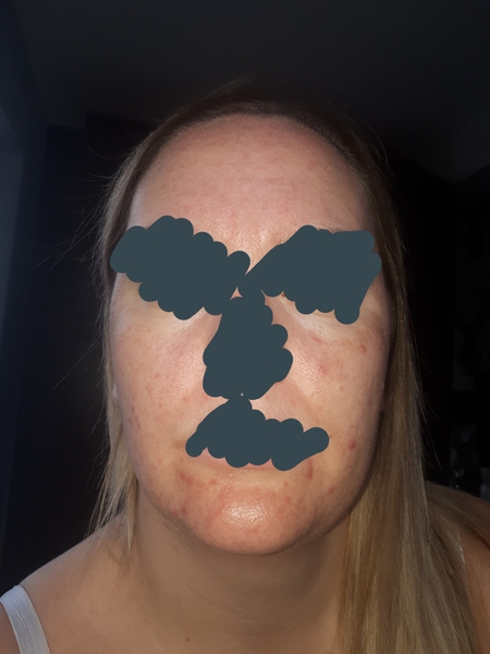 To take my face to the docs?