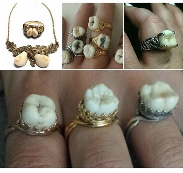 I can’t decide on gold, silver or rose gold?