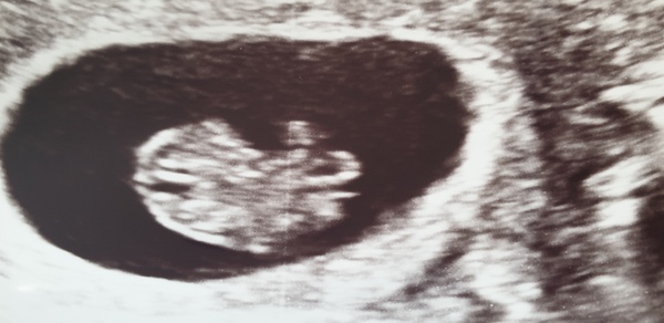 The Graduates of TTC after pregnancy loss thread #2 "The Penguin Huddle " 🐧🐧🐧