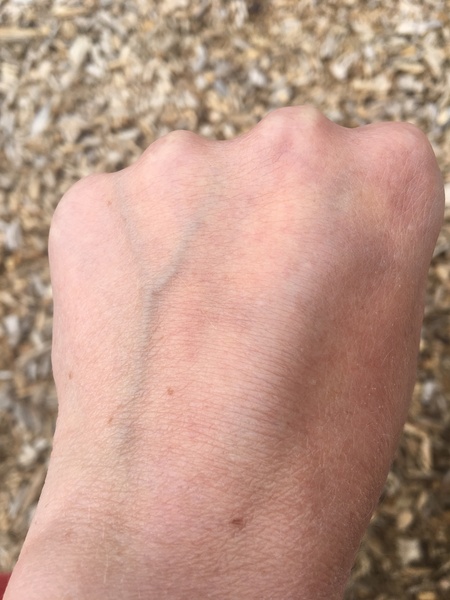 Who else is ‘loved’ by mosquitoes and other biting flies?