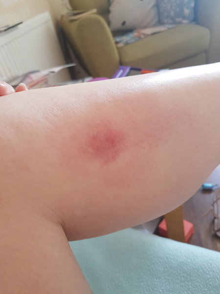 To wonder what the heck has bitten me?!