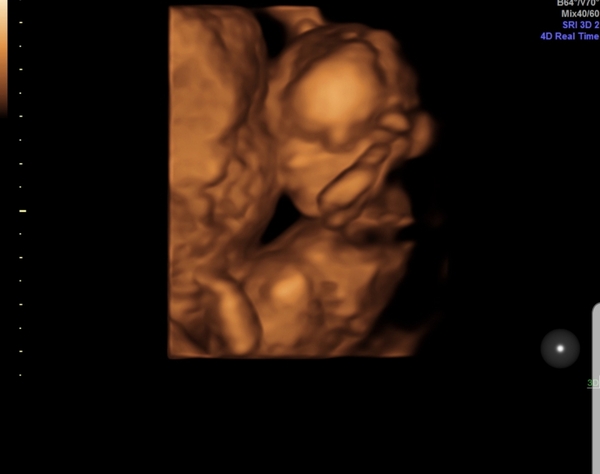 Boy or Girl? I Have My Gender Scan Sunday!