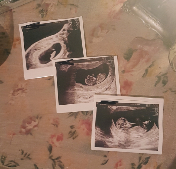 January babies, pregnant after miscarriage :)