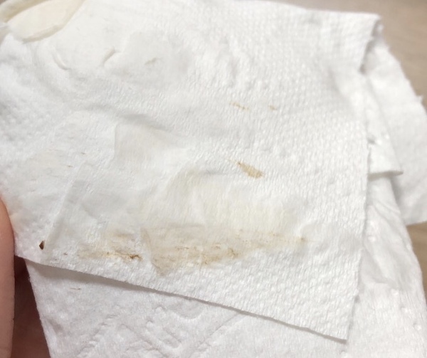 Please help! TMI- little bit of bleeding photos