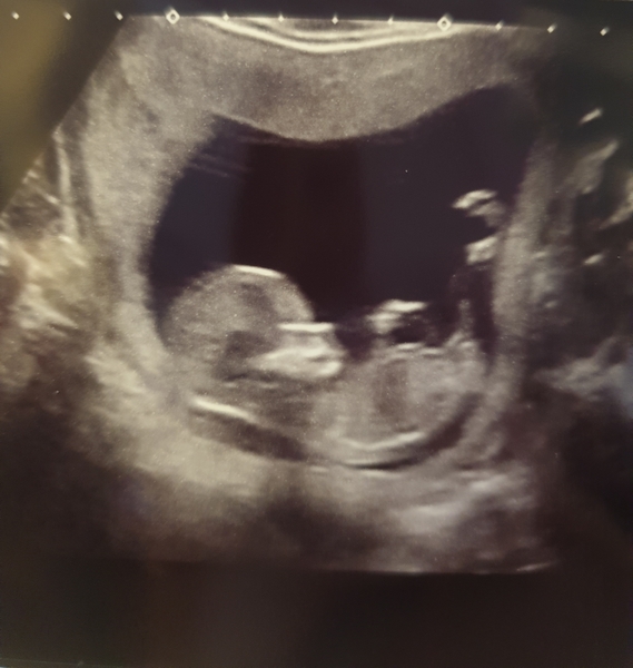 Jan 2020 - Thread 5!!