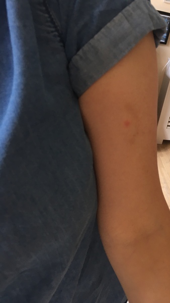 Is this a tick bite?