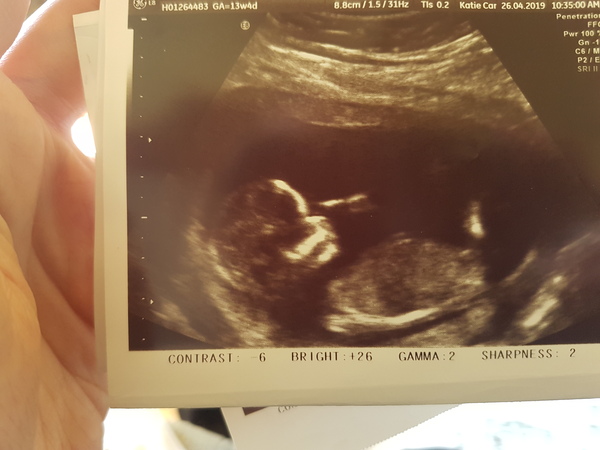 boy or girl, just for fun 😍