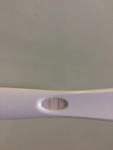 First Pregnancy Missed Miscarriage (Part III)