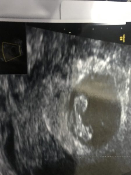 BFP - Anyone else due February 2020?