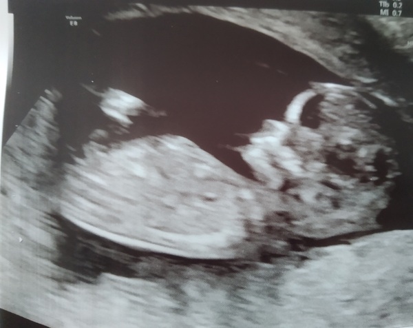 Girl or Boy? Place your bets now and answer will be revealed! *LIGHT HEARTED*